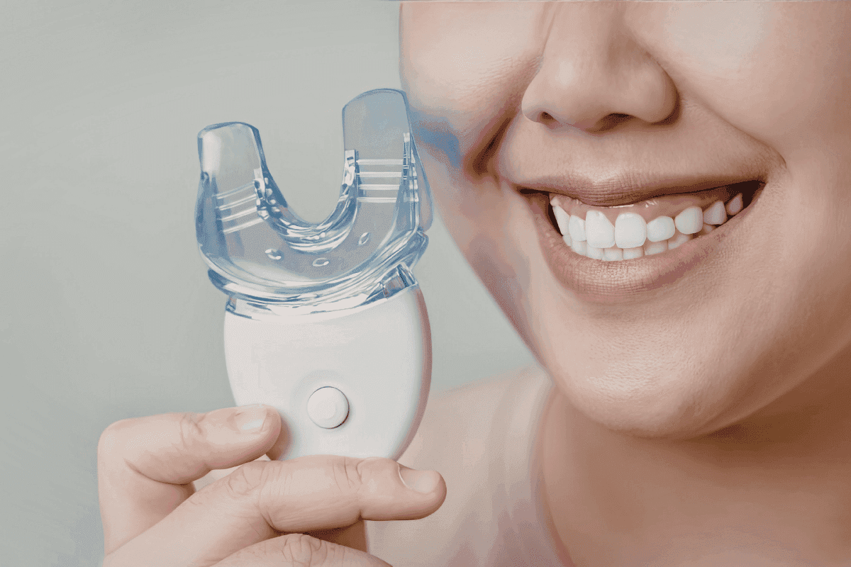 Bleaching Trays